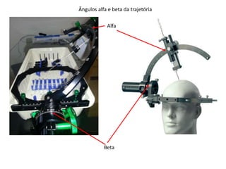 Ângulos alfa e beta da trajetória
Beta
Alfa
 