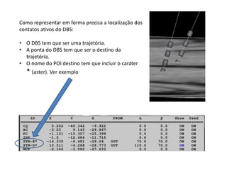 Como representar em forma precisa a localização dos
contatos ativos do DBS:
• O DBS tem que ser uma trajetória.
• A ponta do DBS tem que ser o destino da
trajetória.
• O nome do POI destino tem que incluir o caráter
* (aster). Ver exemplo
 