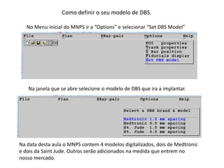 Como definir o seu modelo de DBS.
No Menu inicial do MNPS ir a “Options” e selecionar “Set DBS Model”
Na janela que se abre selecione o modelo de DBS que ira a implantar.
Na data desta aula o MNPS contem 4 modelos digitalizados, dois de Medtronic
e dois da Saint Jude. Outros serão adicionados na medida que entrem no
nosso mercado.
 