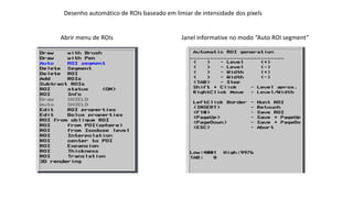 Desenho automático de ROIs baseado em limiar de intensidade dos pixels
Abrir menu de ROIs Janela informativa no modo “Auto ROI segment”
 