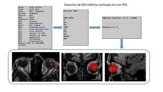 Em casos que o método automático pode ser aplicado se conseguem resultados superiores ao
manual em tempos bem menores.
 