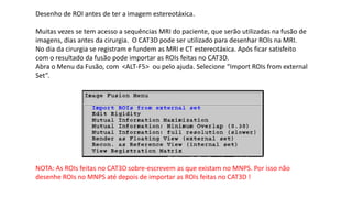 Translação de uma ROI.
É uma translação em 3D, movimenta o volume completo
 