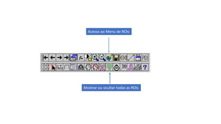 ROIs apresentadas em vários
planos e formas.
 