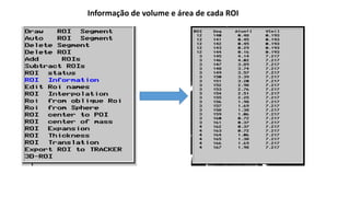 Mostrar ou ocultar todas as ROIs
Acesso ao Menu de ROIs
 