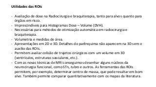 Utilidades das ROIs
- Avaliação de dose na Radiocirurgia e braquiterapia, tanto para alvos quanto para
órgãos em risco.
- Imprescindíveis para Histogramas Dose – Volume (DVH).
- Necessárias para métodos de otimização automática em radiocirurgia e
braquiterapia.
- Volumetria e medidas de área.
- Apresentações em 2D e 3D. Detalhes do parênquima não aparecem na 3D sem o
auxílio das ROIs.
- Permitem avaliar colisão de trajetos cirúrgicos com um volume em 3D
(ventrículos, estruturas vasculares, etc.).
- Com as novas técnicas de MRI conseguimos desenhar alguns núcleos da
neurocirurgia funcional, como STn, rubro e outros. As ferramentas das ROIs
permitem, por exemplo, determinar centro de massa, que pode resultar em bom
alvo. Também permite comparar quantitativamente com os mapas da literatura.
 