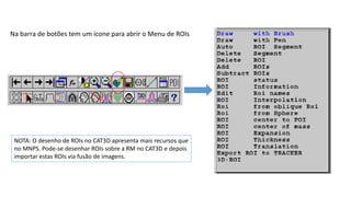 Na barra de botões tem um ícone para abrir o Menu de ROIs
NOTA: O desenho de ROIs no CAT3D apresenta mais recursos que
no MNPS. Pode-se desenhar ROIs sobre a RM no CAT3D e depois
importar estas ROIs via fusão de imagens.
 