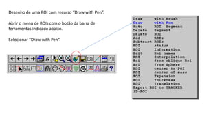 Desenho de uma ROI com recurso “Draw with Pen”.
Abrir o menu de ROIs com o botão da barra de
ferramentas indicado abaixo.
Selecionar “Draw with Pen”.
 