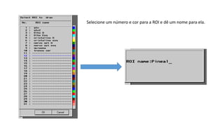 Selecione um número e cor para a ROI e dê um nome para ela.
 
