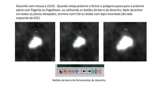 Desenhe com mouse e CLICK. Quando esteja próximo a fechar o polígono passe para o próximo
plano com PageUp ou PageDown, ou utilizando os botões da barra de desenho. Após desenhar
em todos os planos desejados, termine com F10 ou botão com lápis levantado (do lado
esquerdo do ESC).
Botões da barra de ferramentas de desenho
 