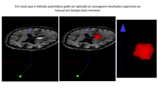 Em casos que o método automático pode ser aplicado se conseguem resultados superiores ao
manual em tempos bem menores.
 