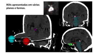 ROIs apresentadas em vários
planos e formas.
 