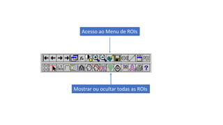 Mostrar ou ocultar todas as ROIs
Acesso ao Menu de ROIs
 
