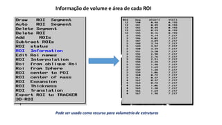 Informação de volume e área de cada ROI
Pode ser usado como recurso para volumetria de estruturas
 