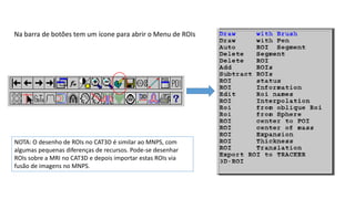 Na barra de botões tem um ícone para abrir o Menu de ROIs
NOTA: O desenho de ROIs no CAT3D é similar ao MNPS, com
algumas pequenas diferenças de recursos. Pode-se desenhar
ROIs sobre a MRI no CAT3D e depois importar estas ROIs via
fusão de imagens no MNPS.
 