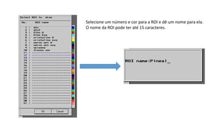 Selecione um número e cor para a ROI e dê um nome para ela.
O nome da ROI pode ter até 15 caracteres.
 