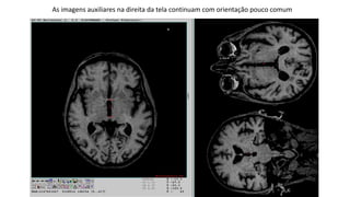 As imagens auxiliares na direita da tela continuam com orientação pouco comum
 