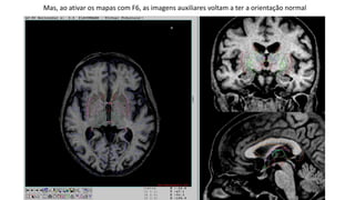 Mas, ao ativar os mapas com F6, as imagens auxiliares voltam a ter a orientação normal
 
