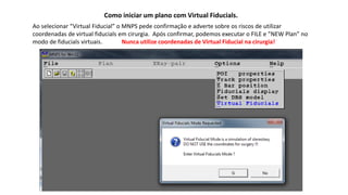Como iniciar um plano com Virtual Fiducials.
Ao selecionar “Virtual Fiducial” o MNPS pede confirmação e adverte sobre os riscos de utilizar
coordenadas de virtual fiducials em cirurgia. Após confirmar, podemos executar o FILE e ”NEW Plan” no
modo de fiducials virtuais. Nunca utilize coordenadas de Virtual Fiducial na cirurgia!
 