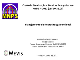 Curso de Atualização e Técnicas Avançadas em
MNPS – 2017 (ver 10.36.00)
Planejamento de Neurocirurgia Funcional
Armando Alaminos Bouza.
Físico-Médico
Equipe de desenvolvimento do MNPS/CAT3D
Mevis Informática Médica LTDA. Brasil
São Paulo. Junho de 2017
 