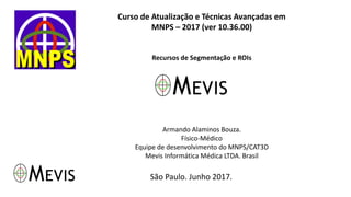Curso de Atualização e Técnicas Avançadas em
MNPS – 2017 (ver 10.36.00)
Recursos de Segmentação e ROIs
Armando Alaminos Bouza.
Físico-Médico
Equipe de desenvolvimento do MNPS/CAT3D
Mevis Informática Médica LTDA. Brasil
São Paulo. Junho 2017.
 