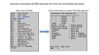 Desenho automático de ROIs baseado em limiar de intensidade dos pixels
Abrir menu de ROIs Janela informativa no modo “Auto ROI segment”
 
