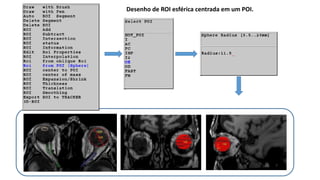 Desenho de ROI esférica centrada em um POI.
 