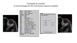 Translação de uma ROI.
É uma translação em 3D, movimenta o volume completo
 