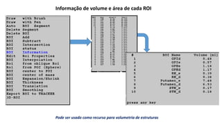Informação de volume e área de cada ROI
Pode ser usado como recurso para volumetria de estruturas
 