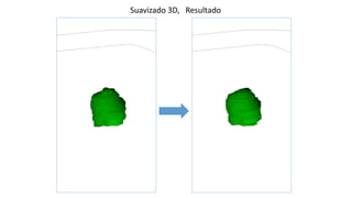 Suavizado 3D, Resultado
 