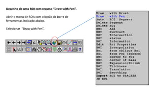 Desenho de uma ROI com recurso “Draw with Pen”.
Abrir o menu de ROIs com o botão da barra de
ferramentas indicado abaixo.
Selecionar “Draw with Pen”.
 
