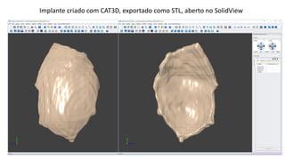 Implante criado com CAT3D, exportado como STL, aberto no SolidView
 