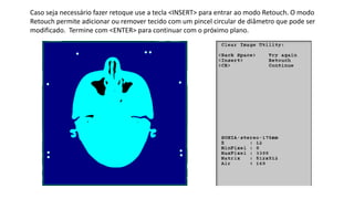 Caso seja necessário fazer retoque use a tecla <INSERT> para entrar ao modo Retouch. O modo
Retouch permite adicionar ou remover tecido com um pincel circular de diâmetro que pode ser
modificado. Termine com <ENTER> para continuar com o próximo plano.
 