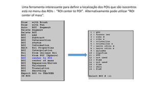 Uma ferramenta interessante para definir a localização dos POIs que são isocentros
está no menu das ROIs : “ROI center to POI”. Alternativamente pode utilizar “ROI
center of mass”.
 