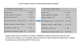 Como mudou o índice de conformidade após otimização
Ambos índices tiveram melhorias. O índice 1 (Paddick) é melhor quanto mais perto de 1.00.
O índice de 2 (Jackie, et. al.) é perfeito quando seja 0.0, ele mede a distância média entre a isodose
de prescrição e a borda do alvo (PTV neste caso).
 
