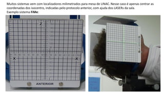 Muitos sistemas vem com localizadores milimetrados para mesa de LINAC. Nesse caso é apenas centrar as
coordenadas dos isocentro, indicadas pelo protocolo anterior, com ajuda dos LASERs da sala.
Exemplo sistema FiMe:
 