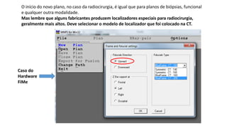O início do novo plano, no caso da radiocirurgia, é igual que para planos de biópsias, funcional
e qualquer outra modalidade.
Mas lembre que alguns fabricantes produzem localizadores especiais para radiocirurgia,
geralmente mais altos. Deve selecionar o modelo de localizador que foi colocado na CT.
Caso do
Hardware
FiMe
 