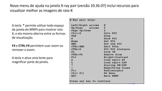 Novo menu de ajuda na janela X-ray pair (versão 10.36.07) inclui recursos para
visualizar melhor as imagens de raio-X
A tecla * permite utilizar todo espaço
da janela do MNPS para mostrar raio-
X, e ela mesma alterna entre as formas
de visualização.
F4 e CTRL-F4 permitem usar zoom ou
remover o zoom.
A tecla + ativa uma lente para
magnificar parte da janela.
 