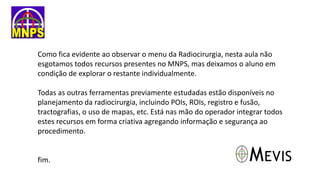 Como fica evidente ao observar o menu da Radiocirurgia, nesta aula não
esgotamos todos recursos presentes no MNPS, mas deixamos o aluno em
condição de explorar o restante individualmente.
Todas as outras ferramentas previamente estudadas estão disponíveis no
planejamento da radiocirurgia, incluindo POIs, ROIs, registro e fusão,
tractografias, o uso de mapas, etc. Está nas mão do operador integrar todos
estes recursos em forma criativa agregando informação e segurança ao
procedimento.
fim.
 