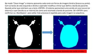 No modo “Clean Image” o sistema apresenta cada corte em forma de imagem binária (branco ou preto).
Com as teclas de seta esquerda e direita o operador modifica o limiar que define a borda do paciente.
Quando achar que está bom use a tecla <ENTER>. O sistema apresentará uma versão em azul escuro (ar
externo) e cyan (tecido ou ar interno) de como será recortada a borda do paciente. Dê <ENTER> para
confirmar ou <BackSpace> para voltar. Este processo é repetido para cada imagem na sequência.
IMPORTANTE : Caso este processo seja esquecido os resultados dosimétricos serão errados !
 