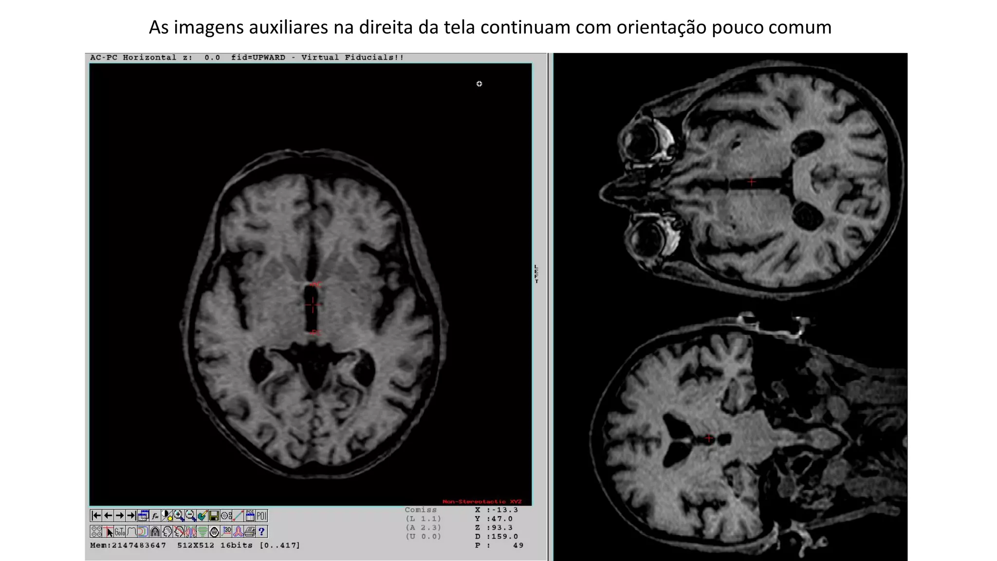 As imagens auxiliares na direita da tela continuam com orientação pouco comum
 