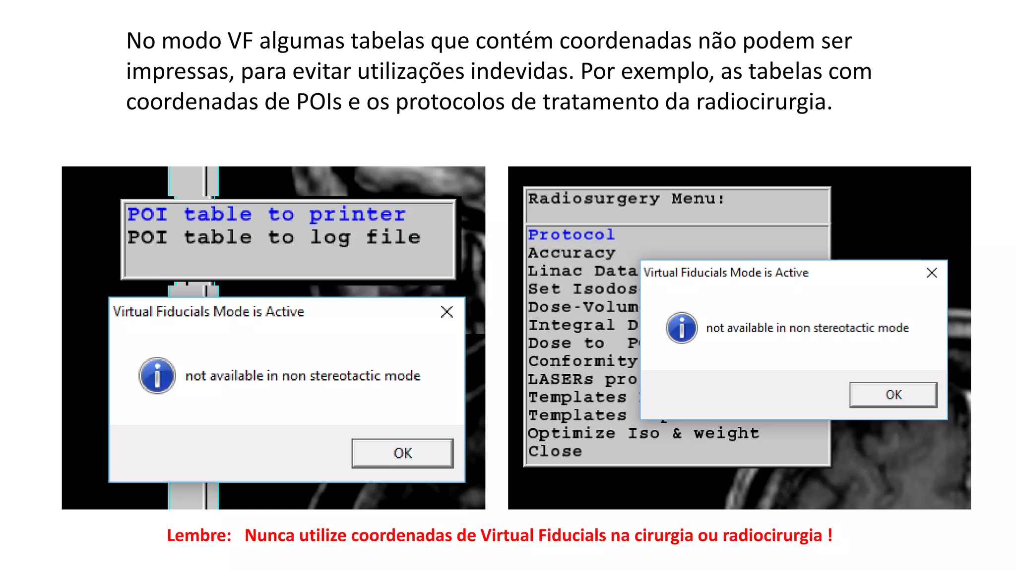 No modo VF algumas tabelas que contém coordenadas não podem ser
impressas, para evitar utilizações indevidas. Por exemplo, as tabelas com
coordenadas de POIs e os protocolos de tratamento da radiocirurgia.
Lembre: Nunca utilize coordenadas de Virtual Fiducials na cirurgia ou radiocirurgia !
 