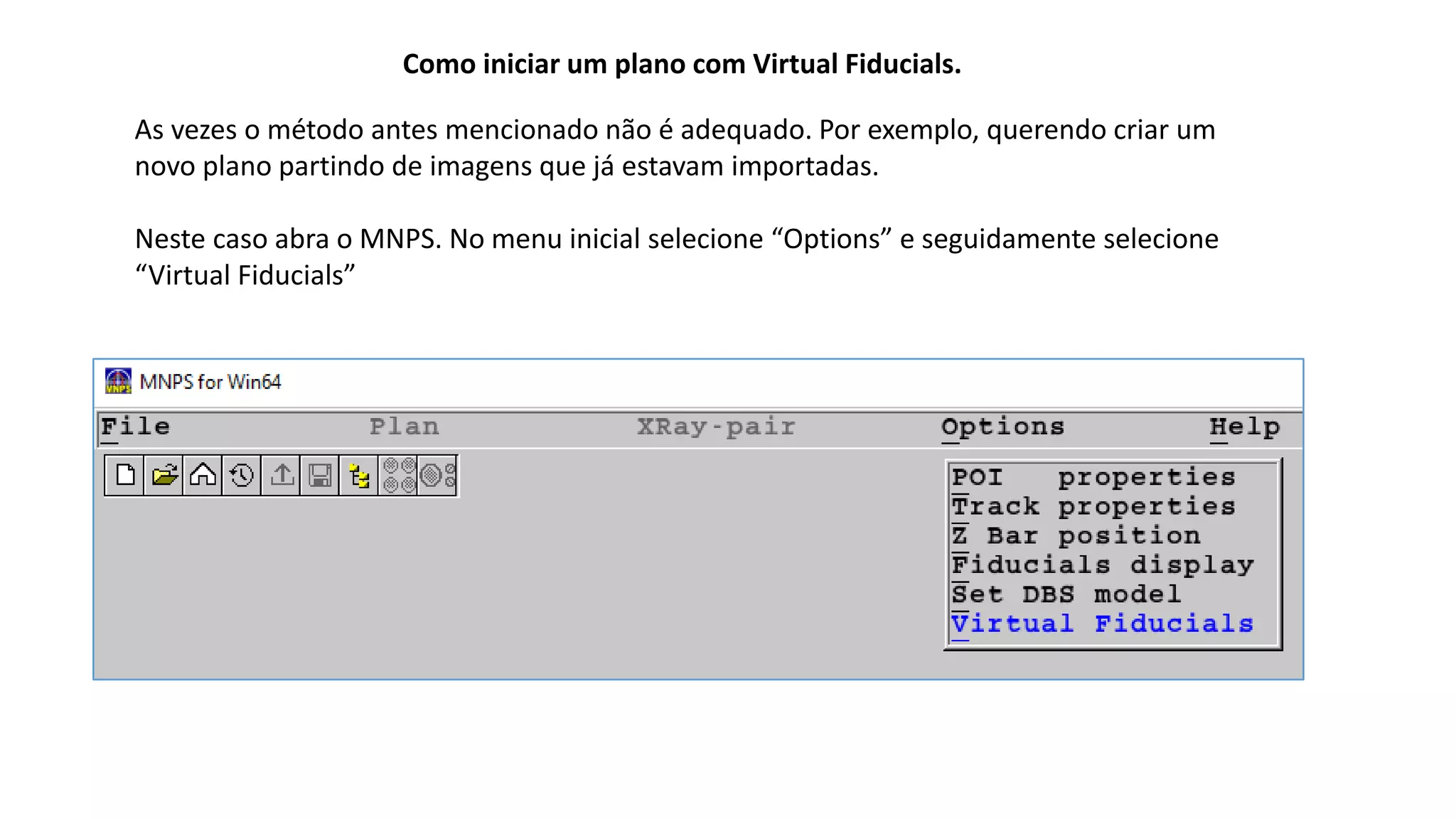 Como iniciar um plano com Virtual Fiducials.
As vezes o método antes mencionado não é adequado. Por exemplo, querendo criar um
novo plano partindo de imagens que já estavam importadas.
Neste caso abra o MNPS. No menu inicial selecione “Options” e seguidamente selecione
“Virtual Fiducials”
 