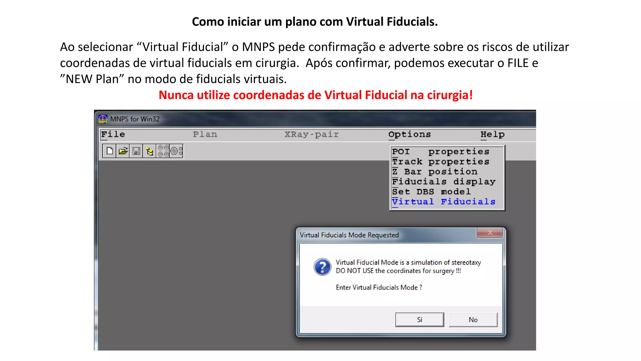 Como iniciar um plano com Virtual Fiducials.
Ao selecionar “Virtual Fiducial” o MNPS pede confirmação e adverte sobre os riscos de utilizar
coordenadas de virtual fiducials em cirurgia. Após confirmar, podemos executar o FILE e
”NEW Plan” no modo de fiducials virtuais.
Nunca utilize coordenadas de Virtual Fiducial na cirurgia!
 