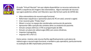 O modo “Virtual Fiducials” tem por objeto disponibilizar os recursos exclusivos do
MNPS a sequências de imagens não estereotáxica. Alguns exemplos de recursos
que agora podemos utilizar sem fiducials e que não formam parte do CAT3D são:
• Atlas estereotáxico da neurocirurgia funcional.
• Reformatar sequências e apresentar plano AC-PC em axial, coronal e sagital.
• Criar reconstruções “Probe-View”.
• Mover o cursor no espaço das coordenadas comissurais do paciente.
• Apresentar DBS e posição dos contatos deles na anatomia do paciente.
• Simular campos elétricos e VTA na programação do DBS.
• Simular um plano de radiocirurgia (SRS) com cones cilíndricos.
• Importar tractografias.
• Importar PET e PET-CT.
Como vamos mostrar, este recurso facilita significativamente o pré-plano da
radiocirurgia e neurocirurgia funcional, e também o pós-operatório, particularmente
na avaliação de DBS implantados previamente.
 
