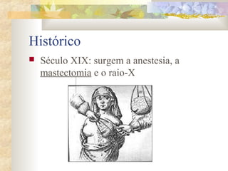 Histórico 
 Século XIX: surgem a anestesia, a 
mastectomia e o raio-X 
 
