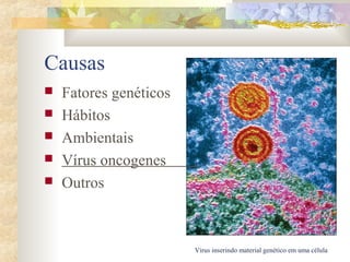 Causas 
 Fatores genéticos 
 Hábitos 
 Ambientais 
 Vírus oncogenes . 
 Outros 
Vírus inserindo material genético em uma célula 
 