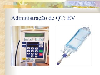 Administração de QT: EV 
 