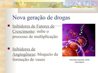 Nova geração de drogas 
 Inibidores de Fatores de 
Crescimento: inibe o 
processo de multiplicação 
 Inibidores de 
Angiogênese: bloqueio da 
formação de vasos Anticorpo atacando célula 
cancerígena 
 