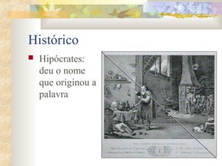 Histórico 
 Hipócrates: 
deu o nome 
que originou a 
palavra 
 