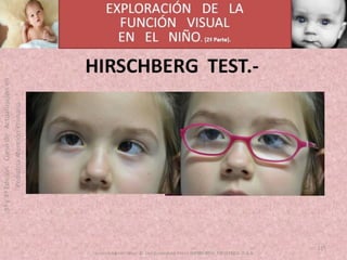 OFTALMOLOGIA BASICA EN PRIMARIA  CURSO